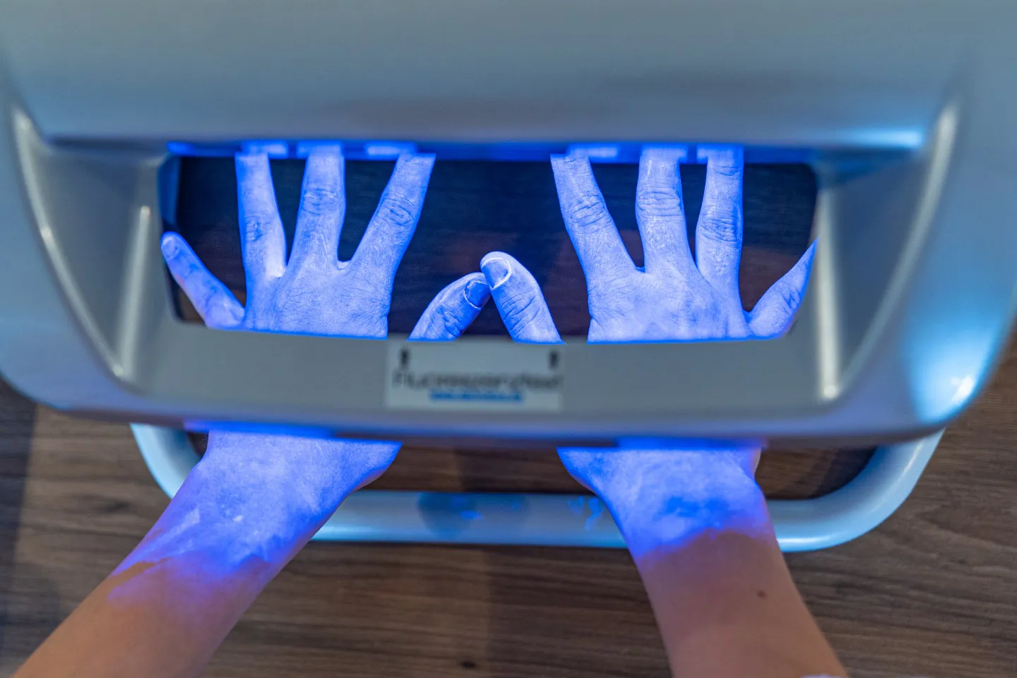 Fluoreszenz Haut 1440 Credit MSK Nahaufnahme der Hände unter dem Fluoreszenzgerät