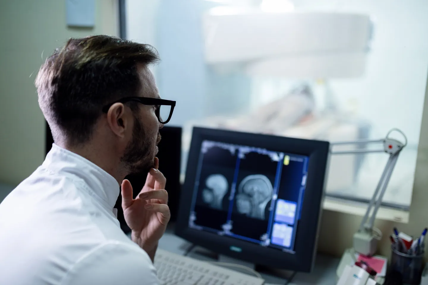 MRT Scan Ergebnis Arzt untersucht am Computerscreen das Hirn-MRT-Scan-Ergebnis eines Patienten.