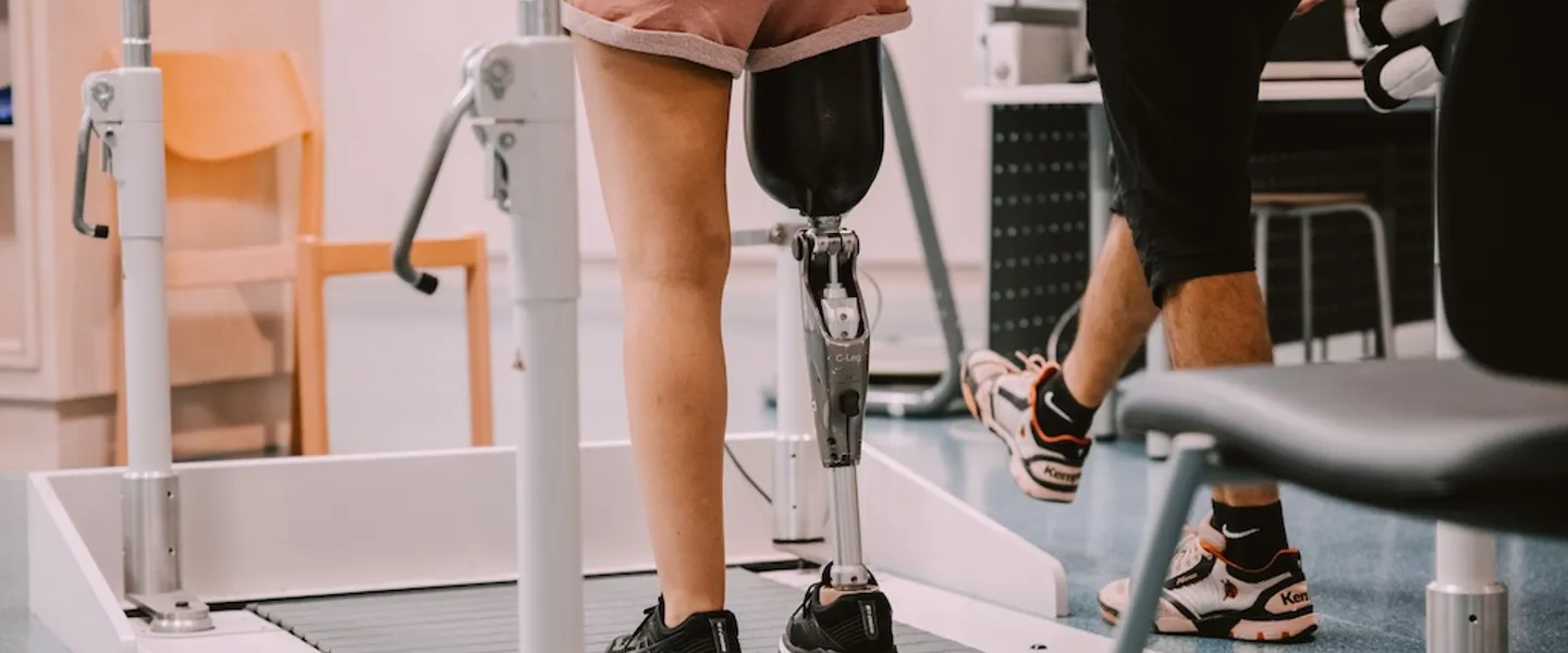 Eine Patientin mit Beinprothese bei einer Gangschulungsübung auf einem Laufband Eine Patientin mit Beinprothese bei einer Gangschulungsübung auf einem Laufband